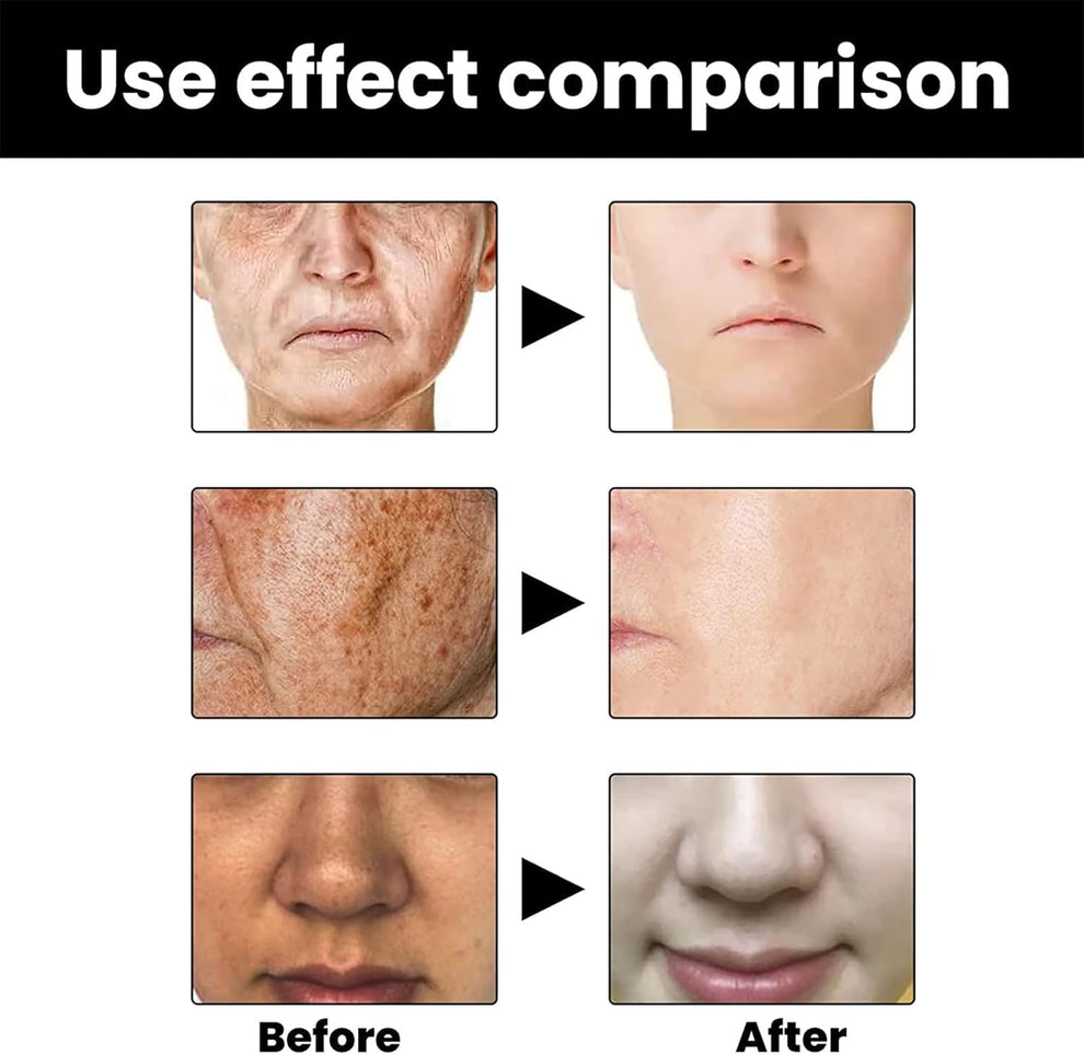 Eelhoe - Melanin Correcting Serum (Original)