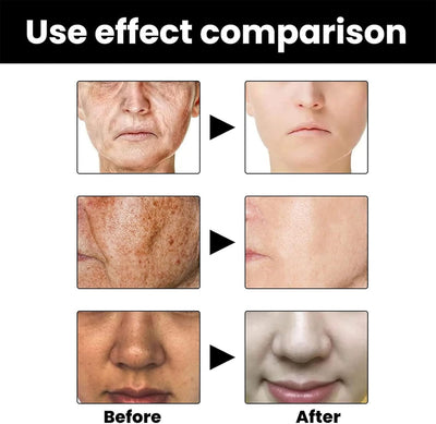 Eelhoe - Melanin Correcting Serum (Original)