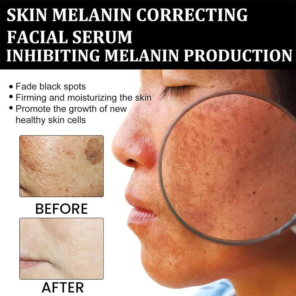Eelhoe - Melanin Correcting Serum (Original)