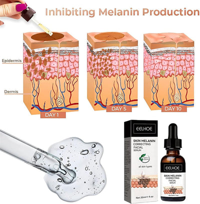 Eelhoe - Melanin Correcting Serum (Original)